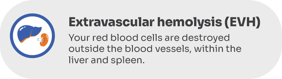 Extravascular hemolysis (EVH): Your red blood cells are destroyed outside the blood vessels, within the liver and spleen.
