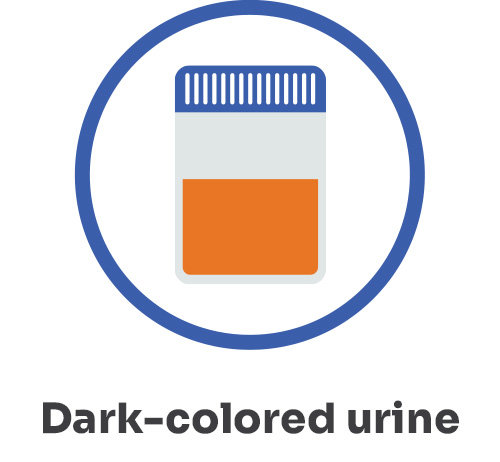 Dark-colored urine